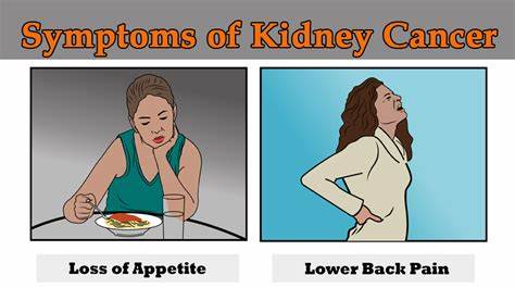 Confronting the Silent Epidemic of Kidney Disease